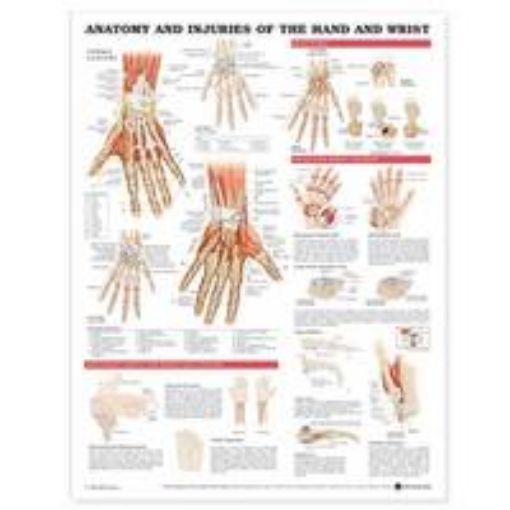 Picture of Anatomy and Injuries of the Hand and Wrist Anatomical Chart
