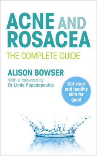 Picture of Acne and Rosacea