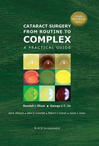 Picture of Cataract Surgery from Routine to Complex