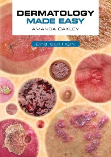 Picture of Dermatology Made Easy, second edition