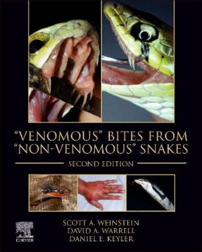 Picture of "Venomous" Bites from "Non-Venomous" Snakes
