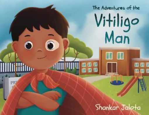 Picture of Adventures of The Vitiligo Man