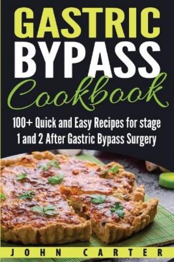 Picture of Gastric Bypass Cookbook