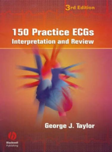 Picture of 150 Practice ECGs