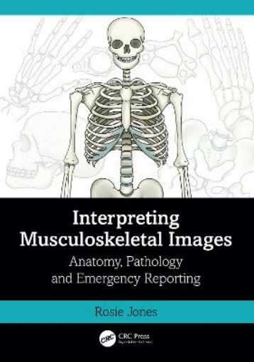 Picture of Interpreting Musculoskeletal Images