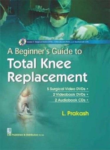 Picture of Beginner's Guide to Total Knee Replacement