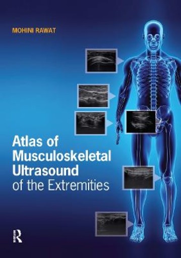 Picture of Atlas of Musculoskeletal Ultrasound of the Extremities