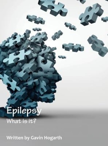 Picture of Epilepsy