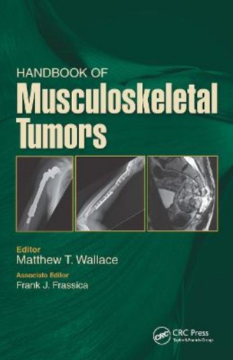 Picture of Handbook of Musculoskeletal Tumors
